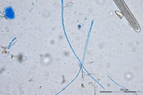 Cercospora Leaf Blight of Soybean